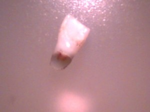 tooth